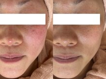 ミュー 春日井店(mieux)