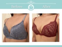 美人バスト 浦和店/【バストアップ★育乳】症例