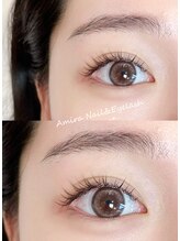 アミーラ(Amira)/フラットラッシュ