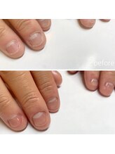 リネイル 長浜(Re-na-iL)/【今だけ】無料相談