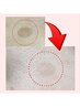 【諦めていたシミ改善】シミケア１０分当て放題 <ポロッポロッ>　￥7,040