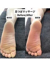 べっぷ餅ヶ浜整体院/足つぼマッサージbefore/after