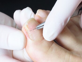 フスフレーゲ 新宿御苑店ルーエの写真/【看護師×足の専門フスフレーゲ】創業25年以上のプロの技で美しく健康な足元へ。セルフケア以上のケアを◎