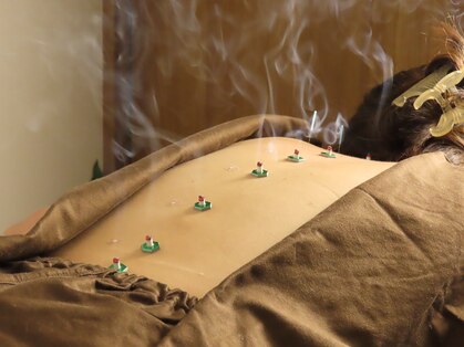 さっぽろ心灯はり きゅう院/ハリスリム 札幌山鼻(Hari-Slim)の写真