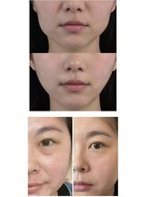 シホン 博多(SHIHON)/