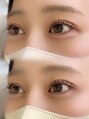 ブランシュ(Blanche) 【Lush lift】初めての方も安心の丁寧なカウンセリング!
