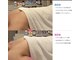 ブエナイン(Buenaine)の写真/わずか1回でバストUP！横に流れたバストの脂肪を戻す・姿勢改善で位置UP・ 巡り改善でふっくら
