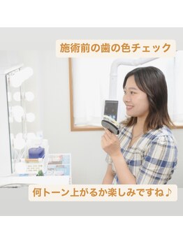 ホワイトニングビューティー 西宮店/歯の色チェック
