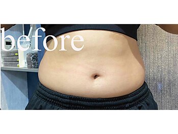 カナウ(kanau)/トリプルボディシェイプ