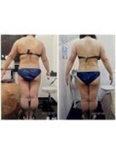 パーフェクトボディプレミアム 渋谷店(PERFECT BODY PREMIUM)/お客様　ビフォーアフター（17）