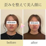 ドゥ ボーテ(de beaute)