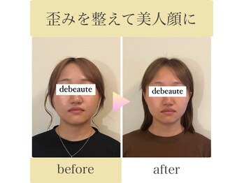 ドゥ ボーテ(de beaute)