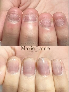 マリーロール 梅田店(Marie Laure)/深爪改善/自爪育成/ネイルケア
