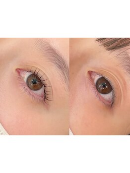 まつげのお悩み解決サロン