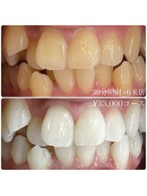 ホワイトニングルーム 川崎店(WhiteningRoom)/ホワイトニング/川崎