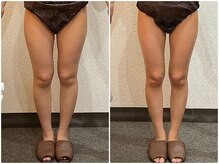 ウェリナ平和堂長久手院/小顔矯正/骨盤矯正/美脚サロン