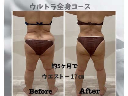 フルーア(FULUA)の写真