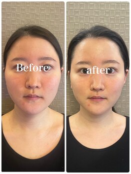 アリィ(Alii)/1度でも変化はしっかり