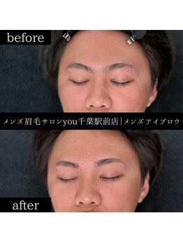 ユー 千葉駅前店(you)/ビフォ－アフター写真