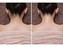 ルネル(Lunelle)/自分でできないうなじを徹底ケア