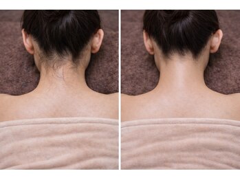 ルネル(Lunelle)/自分でできないうなじを徹底ケア