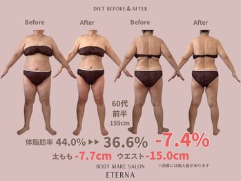 エテルナ(Eterna)/食事改善×エステ