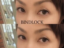 リムピッド(Limpid)/バインドロック60束