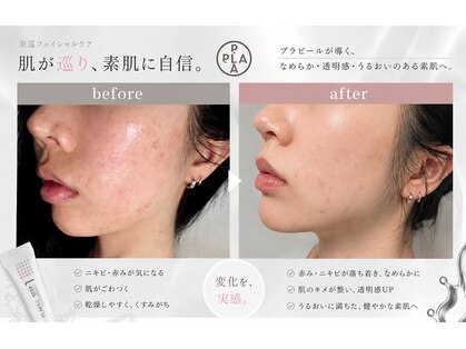 韓国式肌質改善サロン 美巡の写真