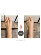 メンズ脱毛ダイアナ 松江店/足先にも気を使って