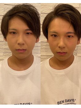 長寿鍼灸院 長寿整骨院/men's男性専用25本美容鍼★