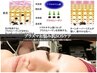 6/14迄【赤み/肌荒れ/鎮静/ニキビ】プラズマお悩み肌SOSケア27500→9900円
