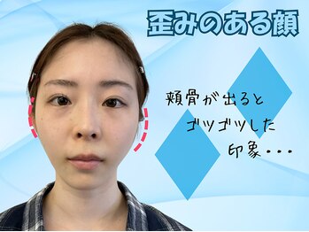 ナチュラルパーフェクトフェイス 新宿/歪みのある顔