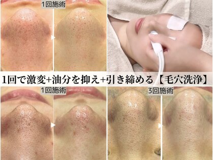 ロワ(Roi)の写真