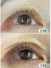 スティーン(Styin)/まつ毛がどんどん元気のなる