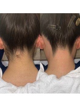 ヴィヴ 熊本(ViV)/うなじWAX+マシンセット