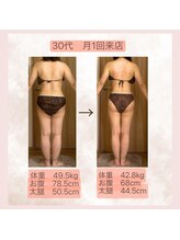 エメカシワ(Aimer KASHIWA)/30代　月1回来店　9回目の変化