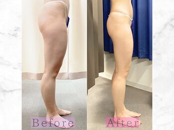 パラディ(PARADIS)の写真/【40代からの下半身太りに】すっきり美脚ケア