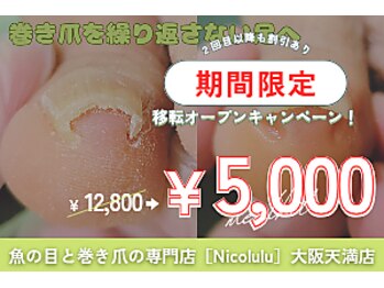 魚の目と巻き爪の専門店　フットケアサロン Nicolulu 大阪天満店【ニコルル】の写真/【仕上がりが目立たない！】マニキュアも楽しめる特許技術の＜巻き爪補正＞ホームケア方法もお伝えします☆