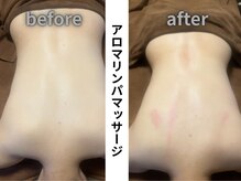 介正鍼灸整骨院 整体院 エフコープ大野城店/アロマリンパ＊ビフォーアフター