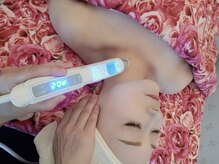 プライベートエステティックサロン アメジスト(AMETHYST)/１番人気、高い効果が理由です。