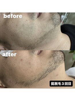 サロン リノ(SALON Lino)/ビフォーアフター