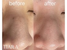 ティアラ 錦糸町(TIARA)/