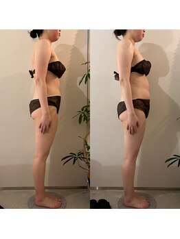 ラナ 京都西院店(Lana)/よもぎ＆全身リンパマッサージ