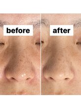 ココン(cocon)/毛穴もスッキリ