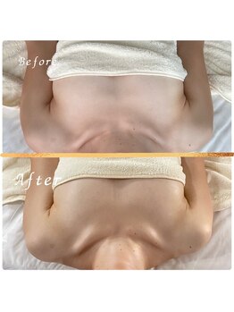 タワワ(TaWaWa)/20代女性　ボリュームでお悩み