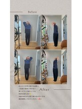 ラキピラティス かわたに接骨院(Lakipilates)/beforeafter