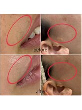 ピース(PEACE)/ツヤ肌フェイシャルワックス