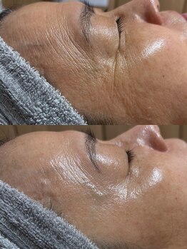 トモニ(TOMONI)/肌質改善サロン　TOMONI