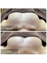 ノルン(Norn)/20代バストケア（3回目）