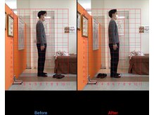 ゼロヒャク整骨院(ZERO100整骨院)/猫背矯正×骨盤矯正